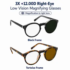 3X +12 diopter right-eye low vision magnifying glasses in black and tortoise frames